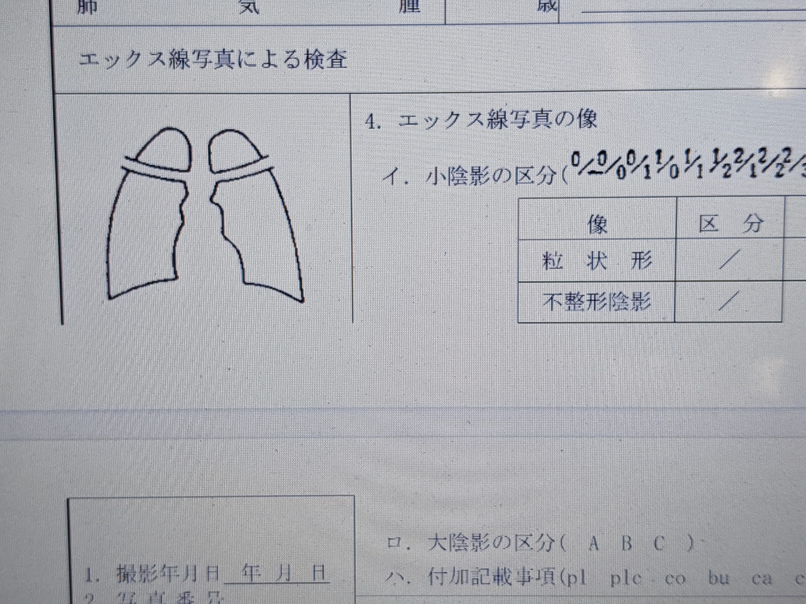 石綿肺とは何ですか?